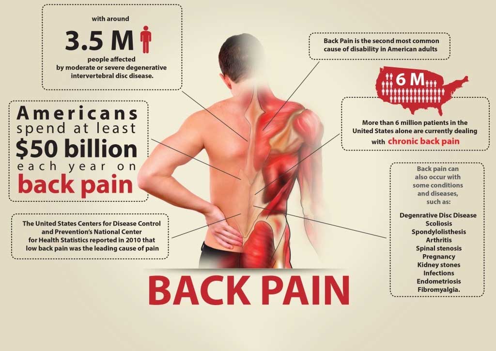 Back Pain